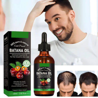 Aceite Batana 100% Natural – Previene la Caída del Cabello y Estimula el Crecimiento Rápido